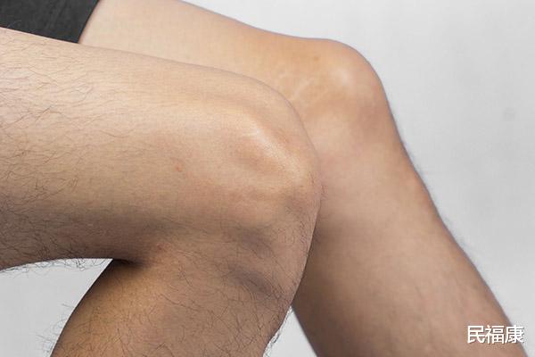 膝关节怕冷, 是什么原因 是关节病态吗 了解一下